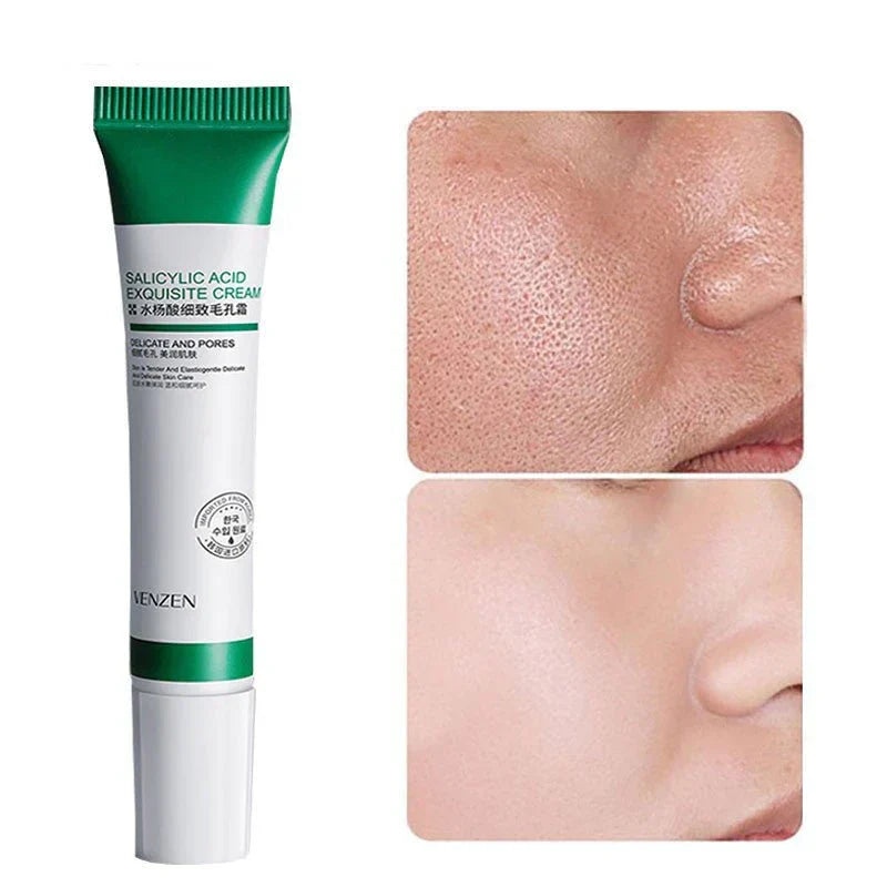Salicylic Acid Pore Refinemen tSkin Care Cream