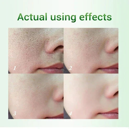 Salicylic Acid Pore Refinemen tSkin Care Cream